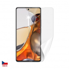 Screenshield fólie na displej pro XIAOMI 11T Pro Screenshield fólie na displej pro XIAOMI 11T Pro